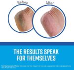 O'Keeffe's Working Hands and Healthy Feet Hand and Foot Crea... - Image 6